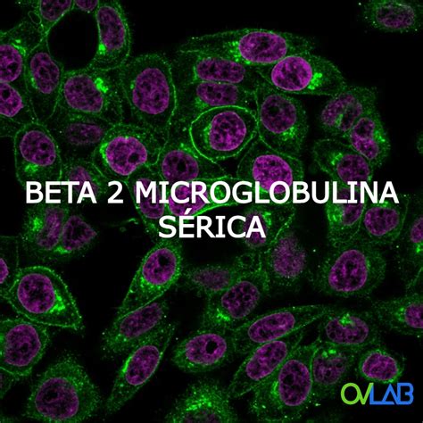 beta 2 microglobulina marcador tumoral